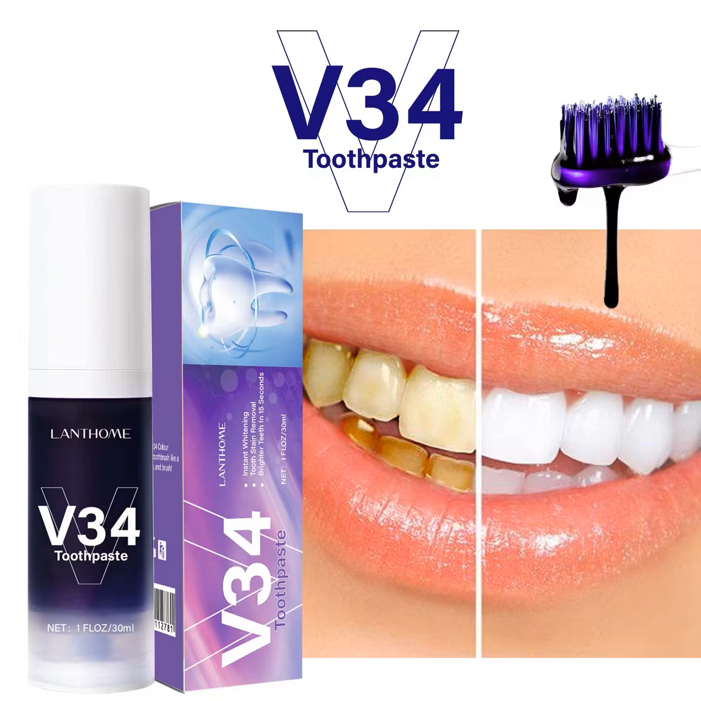 Bright Teeth Kit - Voor een stralende lach, elke dag!